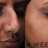 Medik8 Clarity Peptides, 30 ml - Image 7